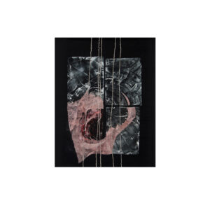 It hurts | Skauda © 2O13